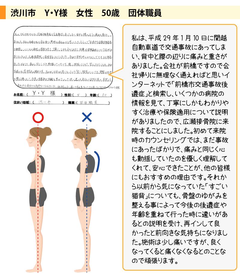 渋川市 Y・Y様 女性 50歳 団体職員 私は、平成29年1月10日に関越自動車道で交通事故にあってしまい、背中と腰の辺りに痛みと重さがありました。会社が前橋ですので会社帰りに無理なく通えればと思いインターネットで「前橋市交通事故後遺症」と検索し、いくつかの病院の情報を見て、丁寧にしかもわかりやすく治療や保険適用について説明がありましたので、広瀬接骨院に来院することにしました。初めて来院時のカウンセリングでは、まだ事故にあったばかりで、痛みと同じく心も動揺していたのを優しく理解してくれて、安心できたことが、他の皆様にもおすすめの理由です。それから以前から気になっていた「すごい猫背」についても、骨盤のゆがみを整える事によって今後の後遺症や年齢を重ねて行った時に違いがあるとの説明を受け、再インして良かったと前向きな気持ちになりました。施術少し痛いですが、良くなってくると痛くなくなるとのことなので頑張ります。